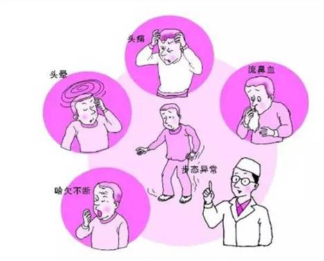 經(jīng)顱多普勒分析儀檢測(cè)中風(fēng)，腦卒中的臨床表現(xiàn)有哪些